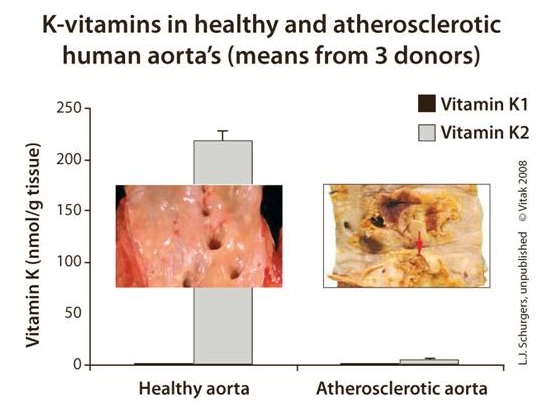Figure 1: Photo of vitamin K2-deficient and vitamin K2-nourished aortas. Note that the aorta on the left has adequate levels of vitamin K2 and is free of calcium deposits, whereas the vitamin K2 deficient aorta on the right is highly calcified. Photo courtesy of Dr. Leon Schurgers.