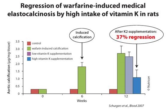 Figure 6: Vitamin K2 reduces warfarin-induced arterial calcification. Courtesy of Dr. Schrugers.